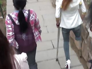 Amputee Chinese Girl Down Stairs With Crutches